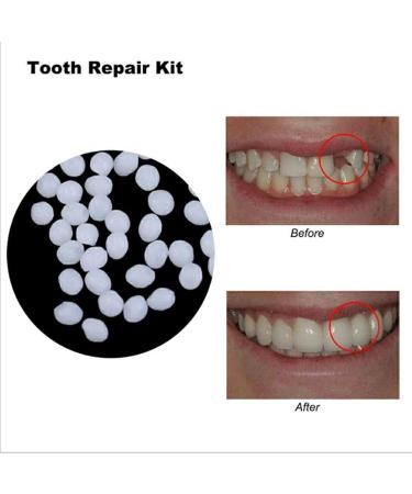Jojomi Thermo-Pearl Tooth Veneer Set | Temporary Denture Repair for Broken & Missing Teeth | 20g - Buy Online on GoSupps.com