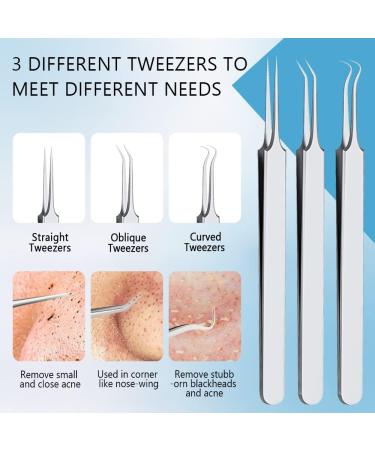 Professional 9 PCS Blackhead & Earwax Removal Kit - Stainless Extractor & Pimple Popper Tools Set with Cleaning Brush and Storage Box - Buy Online on GoSupps.com