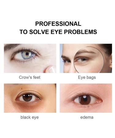 Magic Eye Cream - Anti Aging Treatment for Under Eye Bags, Wrinkles, Puffiness & Dark Circles - Buy Online on GoSupps.com