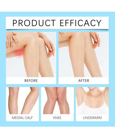  Jingmiger Anti-chafing cream 15 g waterproof anti-chafing spray for thighs and feet anti-abrasive cream anti-chafing balm protection for thighs and men - Buy Online on GoSupps.com