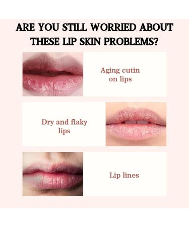 Lip Balm Propolis Lip Scrub Gel Lip Scrub Exfoliator Lip Lightening For Dark Lips & Women And Men Beeswax For Skin Hydrating Lip Balm For Dry & Chapped & Peeling & Cracked Lips Lip Moisturizer - Buy Online on GoSupps.com