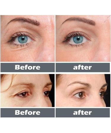 Collagen Boost Anti-Aging Serum collagen serum for face Deep Anti-wrinkle Serum Hyaluronic acid Face serum Anti Aging Face Cream Skincare For Face Serum To Boost Collagen Skin Care(2pc) - Buy Online on GoSupps.com