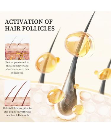 Lot de 5 s rums pour la croissance capillaire s rum pour l'am lioration des follicules pileux doux pour le cuir chevelu fortifiant adapt tous les types de cheveux 2pcs - Buy Online on GoSupps.com