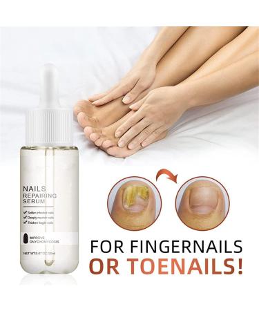 GFOUK 7 Days Nail Growth And Strengthening Serum Nail Growth And Strength Serum Nail Serum Repair Essence Nail Cuticle Oil Strengthener Stronger Nails In 1 Week Nail Strengthening Treatment (1PC) - Buy Online on GoSupps.com