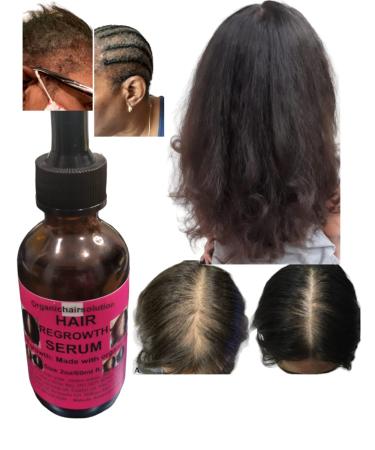Organic Hair Solution: Shampoo Conditioner & Edge Growth Oil with Aloe Vera Avocado Castor Tea Tree Argan Jojoba & Peppermint for Stronger Thicker Longer Hair - Nourish & Strengthen - Buy Online on GoSupps.com