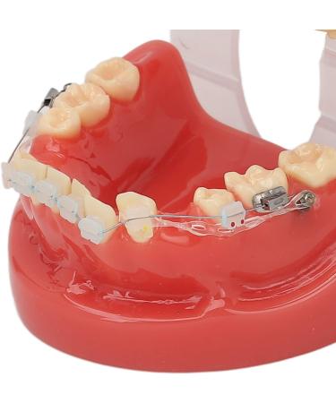 Buy Ververt Touch Ceramic Dental Orthodontic Bracket Model - 24 Teeth Demo Model for Teacher Training | International Shipping Available - Buy Online on GoSupps.com