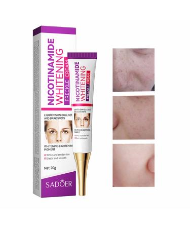 Dark Spot Remover for Face&Body Skin Whitening Freckle Cream Skin Lightening Cream Dark Spots Corrector for Sun Spot Age Spot Smooth Melasma Hyperpigmentation Age Dark Spot Corrector 0.71oz