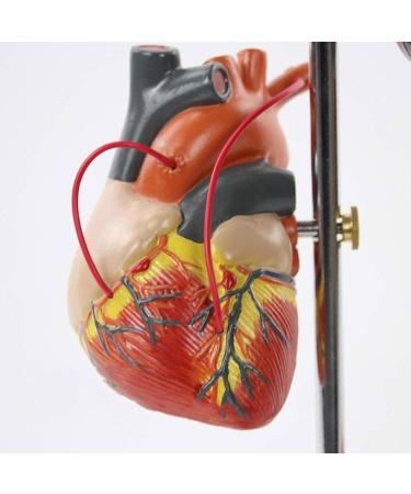 Diabetic Heart Kidney Organ Model PVC Diabetes Pathology Model 5 Removable Parts Eyeball Hear Kidney Vessel Foot Thrombosis Diabetic Fundus School Education Learning Collectibles - Buy Online on GoSupps.com