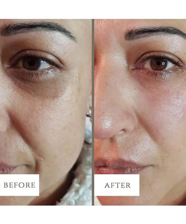 LuxeBiotics Dark Circle Eye Bag Anti-Wrinkle Nourishing Eye Cream - Nourish, Brighten, and Smooth Skin - Buy Online on GoSupps.com