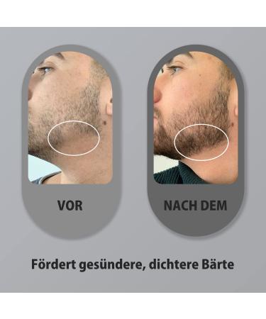 Buy Koi Beauty Bartroller 0.5 mm - Professional Dermaroller for Beard Hair & Skin Care | 540 Titanium Needles for Men & Women | Enhance Hair Growth at Home - Buy Online on GoSupps.com