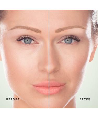 Xtreme Lashes Total Eye Repair Serum 0.5 Fl Oz - Rejuvenate and Refresh Your Eyes - Buy Online on GoSupps.com