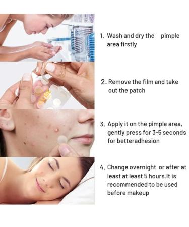 Guise Cosmetics Mighty Patch Original - Hydrocolloid Acne Pimple Patch (36 Count) - Buy Online on GoSupps.com