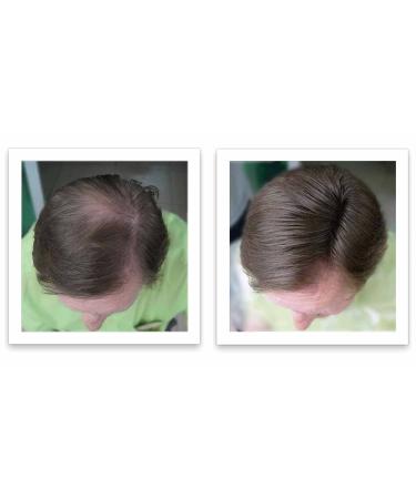 Caboki Travel Size Hair Loss Concealer - All-Natural Hair Building Fibers (Medium Brown) - Buy Online on GoSupps.com