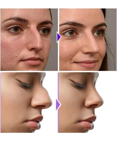 Nasal Mucus Cleaner Smooth Breathing Nasal Mucus Cleaning Device Nasal Mucus Cleaning Clip Nose Shaping Bracket Device 3pcs - Buy Online on GoSupps.com