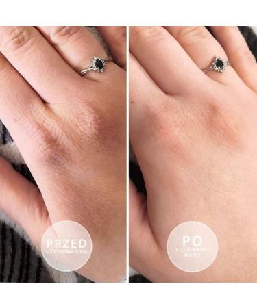 BEAUTICA S.O.S. Intensively oily ointment with vitamin E 100ml - Buy Online on GoSupps.com