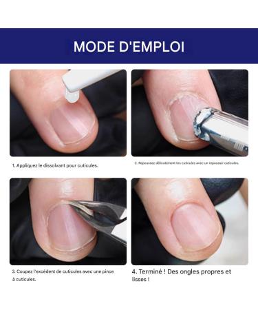 Dissolvant Pour Cuticules | Fournitures De P dicure Hydratantes 30ml Dissolvant Cuticules Action Rapide Pour Ongles | Pour Mains Et Pieds Peau Morte Ongles Ab m s Soin Quotidien Salon - Buy Online on GoSupps.com