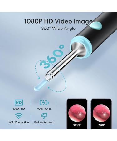 Professional Ear Wax Removal Kit with Camera - 1080P HD Wireless Otoscope for iPhone iPad & Android - Ear Cleaner Tool with Light & Charging Cable (Black - Buy Online on GoSupps.com
