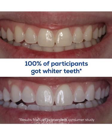 GLO Science GLO Classic Teeth Whitening Kit - Sensitive Teeth, Blue LED Light Technology - Buy Online on GoSupps.com