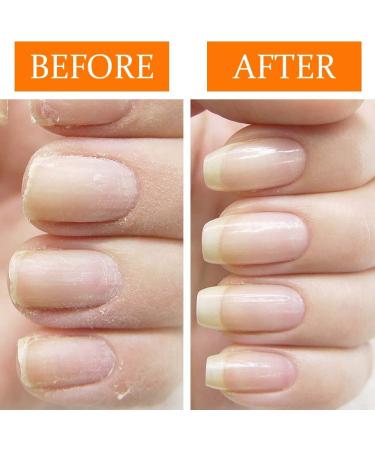 Nail Tek Nail Recovery Kit: Cuticle Oil, Strengthener, Ridge Filler - Restore Damaged Nails in 3 Steps - Buy Online on GoSupps.com