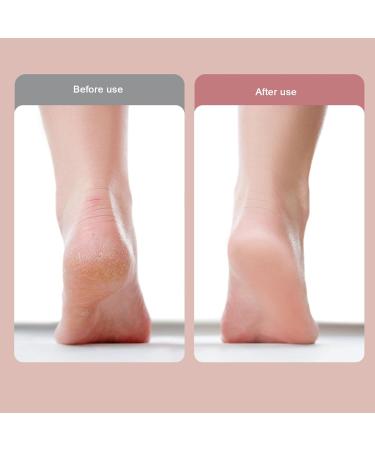 Electric Foot File USB Rechargeable Portable Waterproof Foot File Pedicure Tool for Dead Skin Removal with 2 Speeds Control Adjustable (-1411240090613) Yinhing42goxq9zs0-13 - Buy Online on GoSupps.com