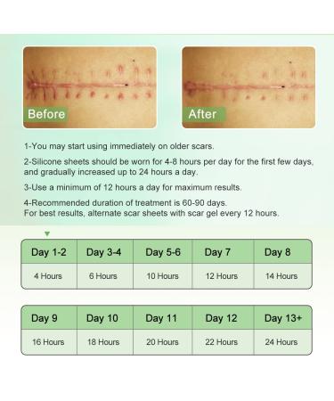 Silicone Scar Sheets 4 Pack for Surgery Scars Treatment - 5.7x1.57 Inch Tape Strips for Keloid, C-Section, Tummy Tuck, Stretch Marks - Surgical Scar Healing Cream Gel Patch Pad - Buy Online on GoSupps.com