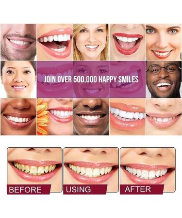 SP4 Fresh Breath & Whitening Toothpaste - Probiotic Lightening Formula for Optimal Oral Health - Buy Online on GoSupps.com