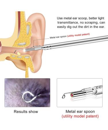 Wireless Otoscope Ear Wax Remover Set | Professional Ear Cleaning Tool with Camera | Healeved Visible Ear Pick | Assorted Colors - Buy Online on GoSupps.com