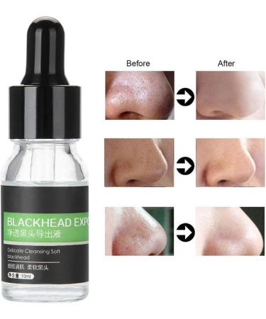 Qukaim Blackhead Liquid Blackhead Shrinkage Essence Export Liquid 10ml Deep Cleansing Blackhead Removal Set - Buy Online on GoSupps.com