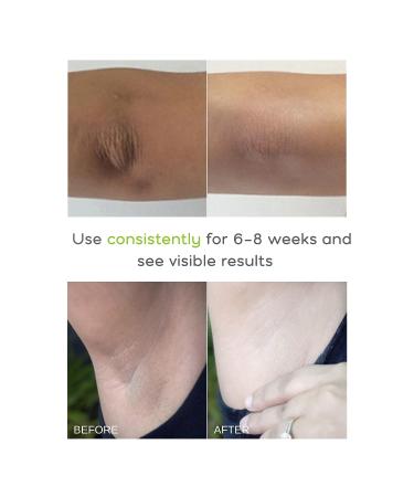 Amaira Natural SOS Skin Improving Cream - Reduce Dark Spots on Face, Underarm & Sensitive Areas - Herbal Body Moisturizer - Buy Online on GoSupps.com