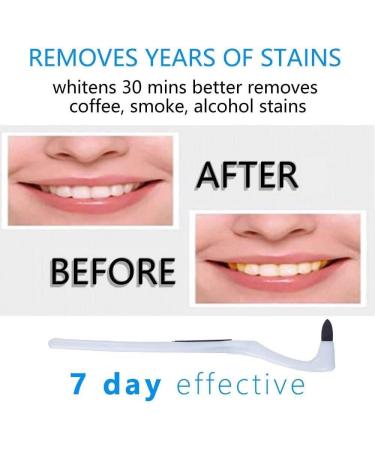 RMFC 2PCS Tartar Remover Tooth Stain Eraser Teeth Polishing/ Cleaning Kit Removes Plaque & Impurities (White & Blue) - Buy Online on GoSupps.com