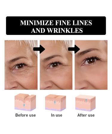 Beepow 2PCS Verfons Firming Snake Venom Eye Cream - Anti-Aging & Instant Eye Bag Removal - Buy Online on GoSupps.com