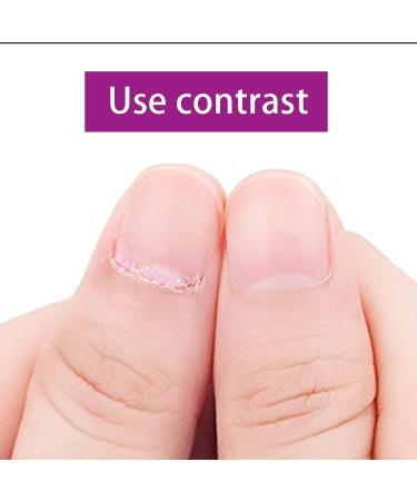 Buy Professional Stainless Steel Nail Skin Pliers & Cuticle Scissors - Purple Manicure & Pedicure Set for Ingrown Toenails - Buy Online on GoSupps.com