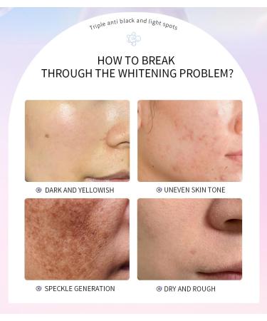 Facial Essence Serum for Spot Reduction Hydrating and Brightening Moisturizing Treatment - Buy Online on GoSupps.com