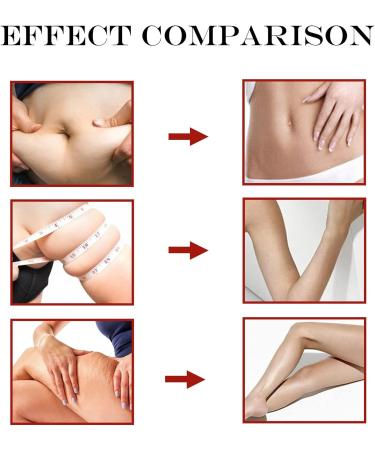 ZBTOP Soothe&Slim Capsule - Anti-Itch Detox, Slimming & Firming Repair (5PCS) - Buy Online on GoSupps.com