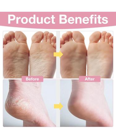 Foreverup Focusing and antiracking foot cream hydrating and antiracking creams ureum foot cream creams for cracked heavily and dry skin - Buy Online on GoSupps.com