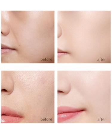 Gold Face Essence Serum - Anti-Aging Moisturizing & Firming with Soluble Protein Thread & Nano Gold for Women - 1 Set - Buy Online on GoSupps.com