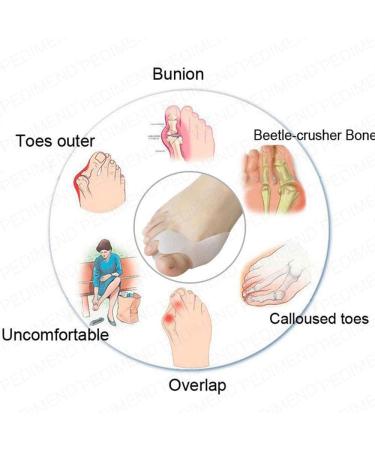 Pedimend Silicone Gel Toe Separator - Hallux Valgus Relief Pain Prevention for Men & Women - 2 Pairs Included - Buy Online on GoSupps.com