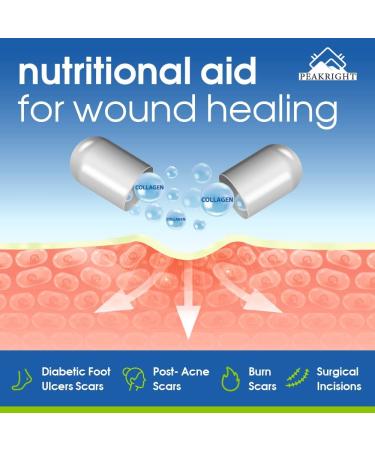 Wound Healing Scar Pills - Made in USA for Surgery Recovery & Support - Reduce Scarring, Bruising, Swelling - Fast Recovery from Plastic & Breast Surgery - Buy Online on GoSupps.com