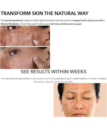 Skinscience Correcteur de taches brunes anti-taches brunes pour le visage et le corps anti-taches de vieillesse pour le visage anti-taches brunes r duit les taches solaires les taches de 1 - Buy Online on GoSupps.com