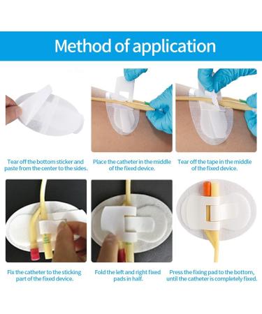 Atacesotaiv 5 pcs Catheter Stabilization Device - Foley Catheter Adhesive Sticker with Foam Anchor Pad - Leg Band Urinary Catheter Hook and Loop Fixing Device (White) - Buy Online on GoSupps.com