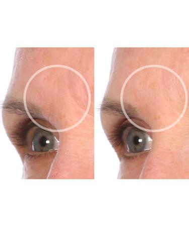 SiO Beauty BrowLift Forehead Anti-Wrinkle Patch - Rapid Overnight Reusable Silicone Patch to Reduce Furrows Expression Lines and Creases - Buy Online on GoSupps.com