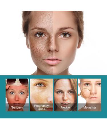 Dark Spot Correcting Serum - Best Dark Spot Remover for Age Spots Sun Spots & Freckles - 30g Body Cream - Buy Online on GoSupps.com