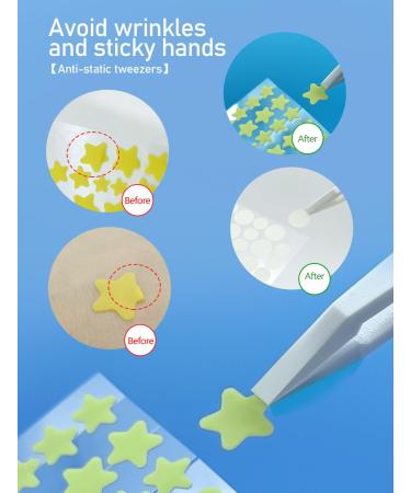 Star Pimple Patches - 316 Count Invisible Acne Treatment Cute Hydrocolloid Zit Covers with Centella Asiatica & Tea Tree Oil | International Shipping - Buy Online on GoSupps.com