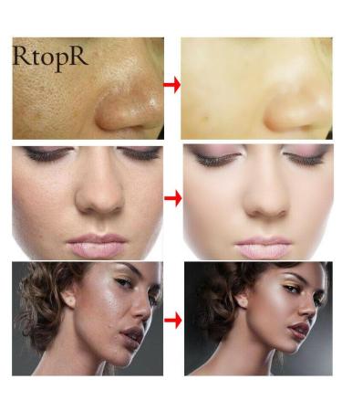 RtopR Mango Soothing & Hydrating Facial Cream | Anti-Dryness & Purifying Skincare - 30g | International Shipping Available - Buy Online on GoSupps.com