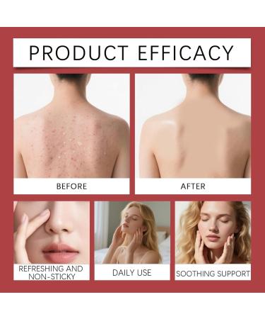 JIAOY Strawberry Skin Resurfacing Cream strawberry skin renewal cream strawberry skin treatment body cream for leg treatment moisturizing antiwrinkle lotion smooth arms and legs 3 pieces 3 pieces - Buy Online on GoSupps.com