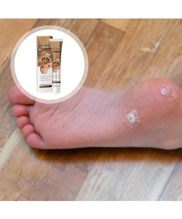 Mole Corrector Skin Blemish Correction Cream Reduces Imperfections 20g Moisturizer Safe for Face Hands Feet and Body - Buy Online on GoSupps.com