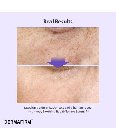  Refill DERMAFIRM Soothing Repair Toning Serum R4 - Korean Bakuchiol Retinol Niacinamide & Peptide Face Serum for Wrinkles - Calming Moisturizing & Correcting- Paraben-Free Cruelty-Free 1.01 fl oz - Buy Online on GoSupps.com