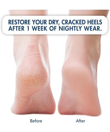 Moisturizing Heel Socks for Cracked Heel Treatment - 2 Pairs by Dr. Frederick's Original - Buy Online on GoSupps.com