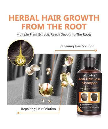 Ginger Hair Growth Shampoo & Conditioner Set | Anti Hair Loss, Promotes Fast Hair Growth, Moisturizes & Strengthens Thin/Damaged Hair - 14.67 oz - Buy Online on GoSupps.com