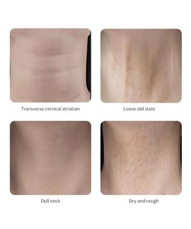 24 Pcs Neck Lift Tape Neck Tape Lifting Invisible for Face Jaw Necks Instant Necks and Face Lift Strap Patch Tightening Tapes (4 Skin Tone Bands + 20 Replacement Tapes) 4pcs Skin Color - Buy Online on GoSupps.com